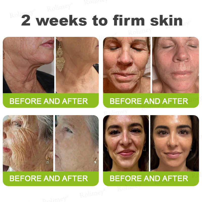 🍈Made and shipped from the UK 💫Rolimey® Botox & Vita-A Retinol Shot Wrinkle-Lift Tightening cream - Last Day Promotion 70% OFF