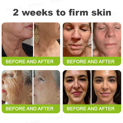 🍈Made and shipped from the UK 💫Rolimey® Botox & Vita-A Retinol Shot Wrinkle-Lift Tightening cream - Last Day Promotion 70% OFF