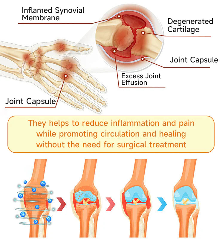🌟Official Shop:Rolimey® Bee Venom Pain Relief Bone Healing Cream 👨‍⚕️(Reduction of joint swelling, pain, stiffness, redness, heat, muscle soreness and joint fatigue)