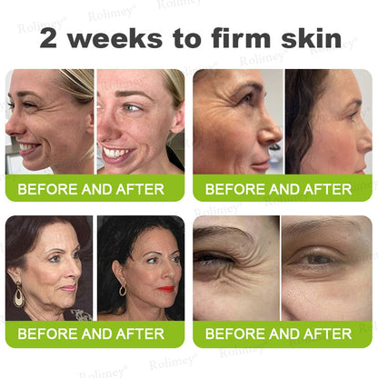 🍈Made and shipped from the UK 💫Rolimey® Botox & Vita-A Retinol Shot Wrinkle-Lift Tightening cream - Last Day Promotion 70% OFF