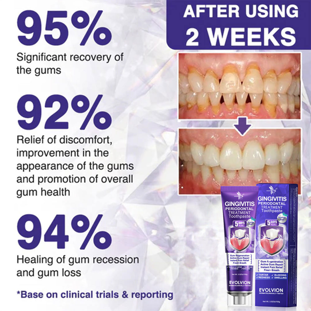 🇬🇧🧑‍⚕️🦷Evolvion® Bee Venom Gingivitis & Periodontitis Treatment Toothpaste🎁