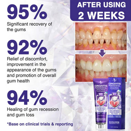 🇬🇧🧑‍⚕️🦷Evolvion® Bee Venom Gingivitis & Periodontitis Treatment Toothpaste🎁