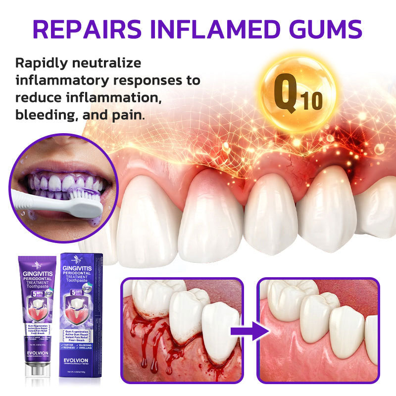 🇬🇧🧑‍⚕️🦷Evolvion® Bee Venom Gingivitis & Periodontitis Treatment Toothpaste🎁