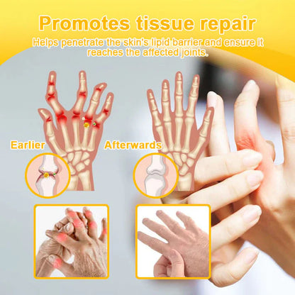 🌟Official Shop:Rolimey® Bee Venom Pain Relief Bone Healing Cream 👨‍⚕️(Reduction of joint swelling, pain, stiffness, redness, heat, muscle soreness and joint fatigue)