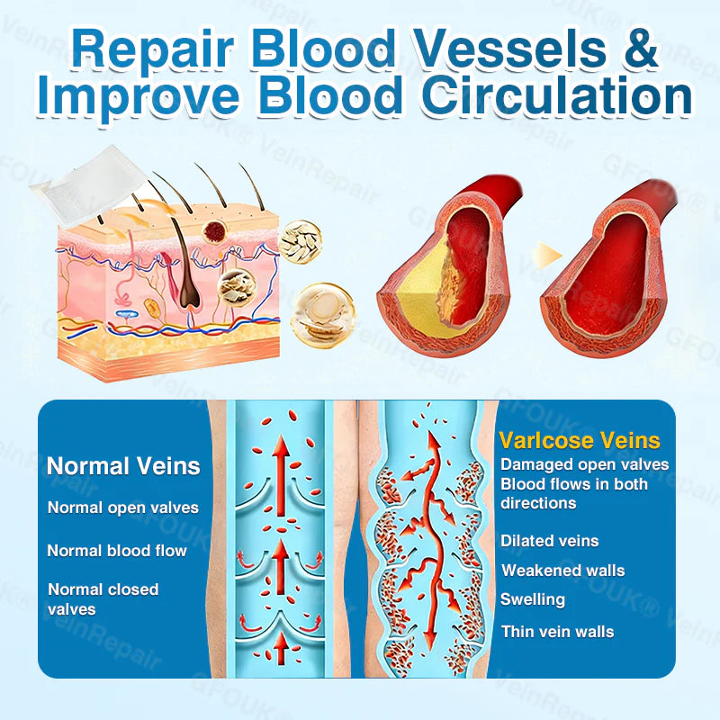 🇬🇧👨‍⚕️⬆️GFOUK® 7-in-1 Pure Natural Vein Repair Patch⚡Instant Relief, Long-Term Results-100% Hormone-Free & Botanical Power