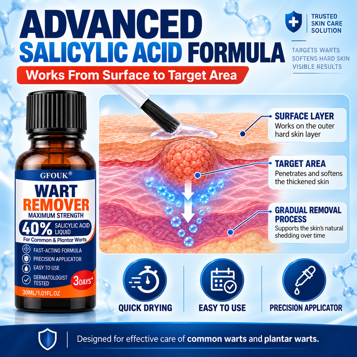 ❄️GFOUK®40% Salicylic Acid Wart Remover Liquid – Maximum Strength Fast-Acting Treatment for Common, Plantar & Flat Warts, Corns & Calluses, 1.01 fl oz