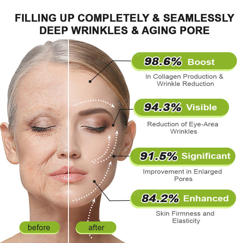 🍈Made and shipped from the UK 💫Rolimey® Botox & Vita-A Retinol Shot Wrinkle-Lift Tightening cream - Last Day Promotion 70% OFF