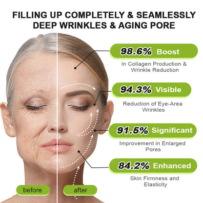 🍈Made and shipped from the UK 💫Rolimey® Botox & Vita-A Retinol Shot Wrinkle-Lift Tightening cream - Last Day Promotion 70% OFF