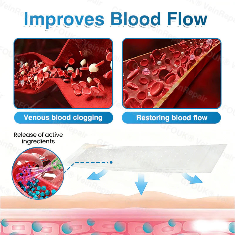 🇬🇧👨‍⚕️⬆️GFOUK® 7-in-1 Pure Natural Vein Repair Patch⚡Instant Relief, Long-Term Results-100% Hormone-Free & Botanical Power