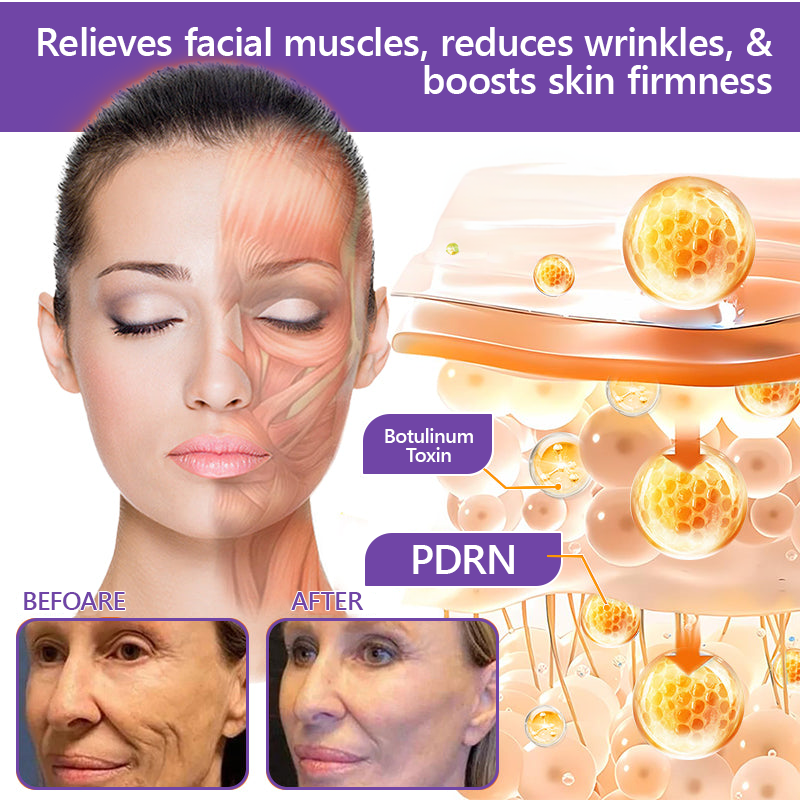 🔥Rolimey® PDRN Multi-Peptide Massaging Roller Cream - Anti-aging, Hydrating, Skin Firming & Lifting, Skin Repair, Even Tone, Acne and Dark Spot Treatment, Wart and Mole Removal, and Psoriasis Relief.