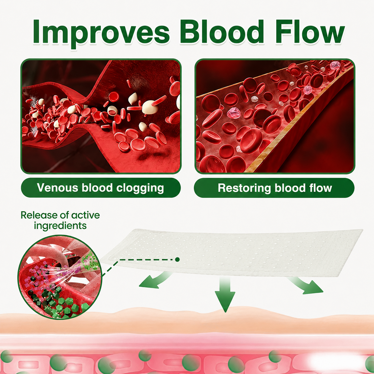 🇬🇧👨‍⚕️GFOUK® 7-in-1 Microneedle Vein & Lipedema Treatment Patch | Non-Surgical Alternative for Varicose Bulges, Spider Veins & Chronic Leg Swelling | Expert Approved