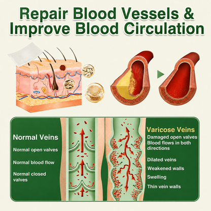 🇬🇧👨‍⚕️GFOUK® 7-in-1 Microneedle Vein & Lipedema Treatment Patch | Non-Surgical Alternative for Varicose Bulges, Spider Veins & Chronic Leg Swelling | Expert Approved