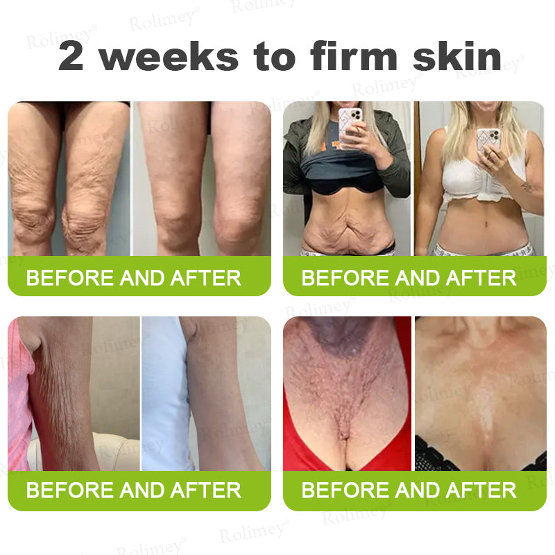 🍈Made and shipped from the UK 💫Rolimey® Botox & Vita-A Retinol Shot Wrinkle-Lift Tightening cream - Last Day Promotion 70% OFF
