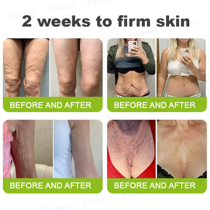 🍈Made and shipped from the UK 💫Rolimey® Botox & Vita-A Retinol Shot Wrinkle-Lift Tightening cream - Last Day Promotion 70% OFF