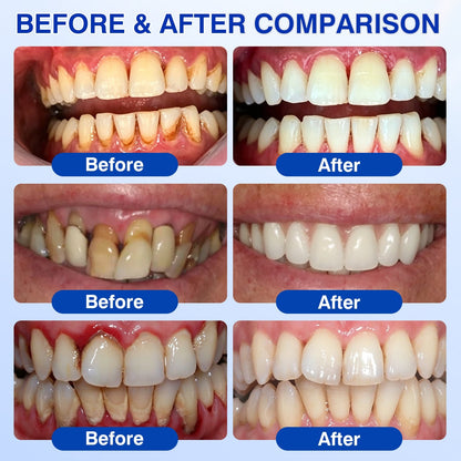 🧑‍⚕️🦷Evolvion® GumVital Advanced Gum Care Gel🛡️