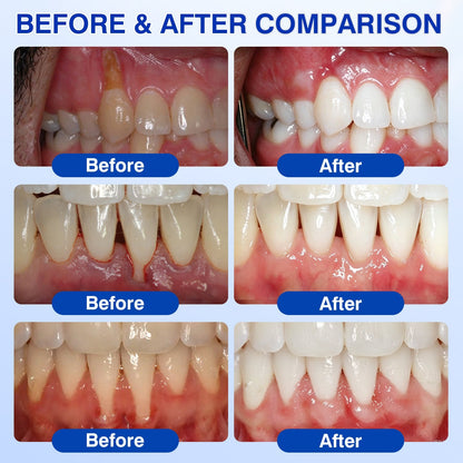 🧑‍⚕️🦷Evolvion® GumVital Advanced Gum Care Gel🛡️