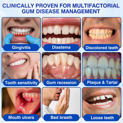 🧑‍⚕️🦷Evolvion® GumVital Advanced Gum Care Gel🛡️