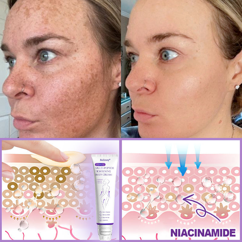🔥Rolimey® PDRN Multi-Peptide Massaging Roller Cream - Anti-aging, Hydrating, Skin Firming & Lifting, Skin Repair, Even Tone, Acne and Dark Spot Treatment, Wart and Mole Removal, and Psoriasis Relief.