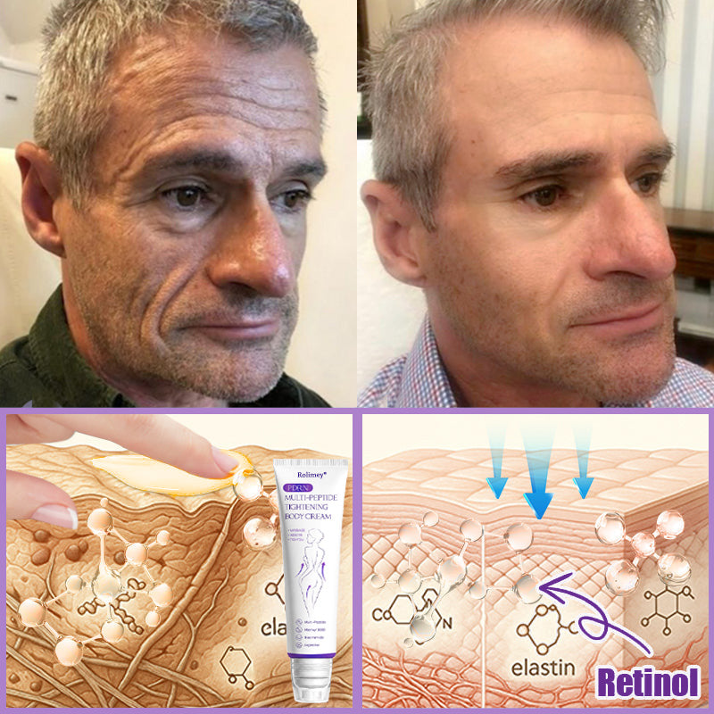 🔥Rolimey® PDRN Multi-Peptide Massaging Roller Cream - Anti-aging, Hydrating, Skin Firming & Lifting, Skin Repair, Even Tone, Acne and Dark Spot Treatment, Wart and Mole Removal, and Psoriasis Relief.