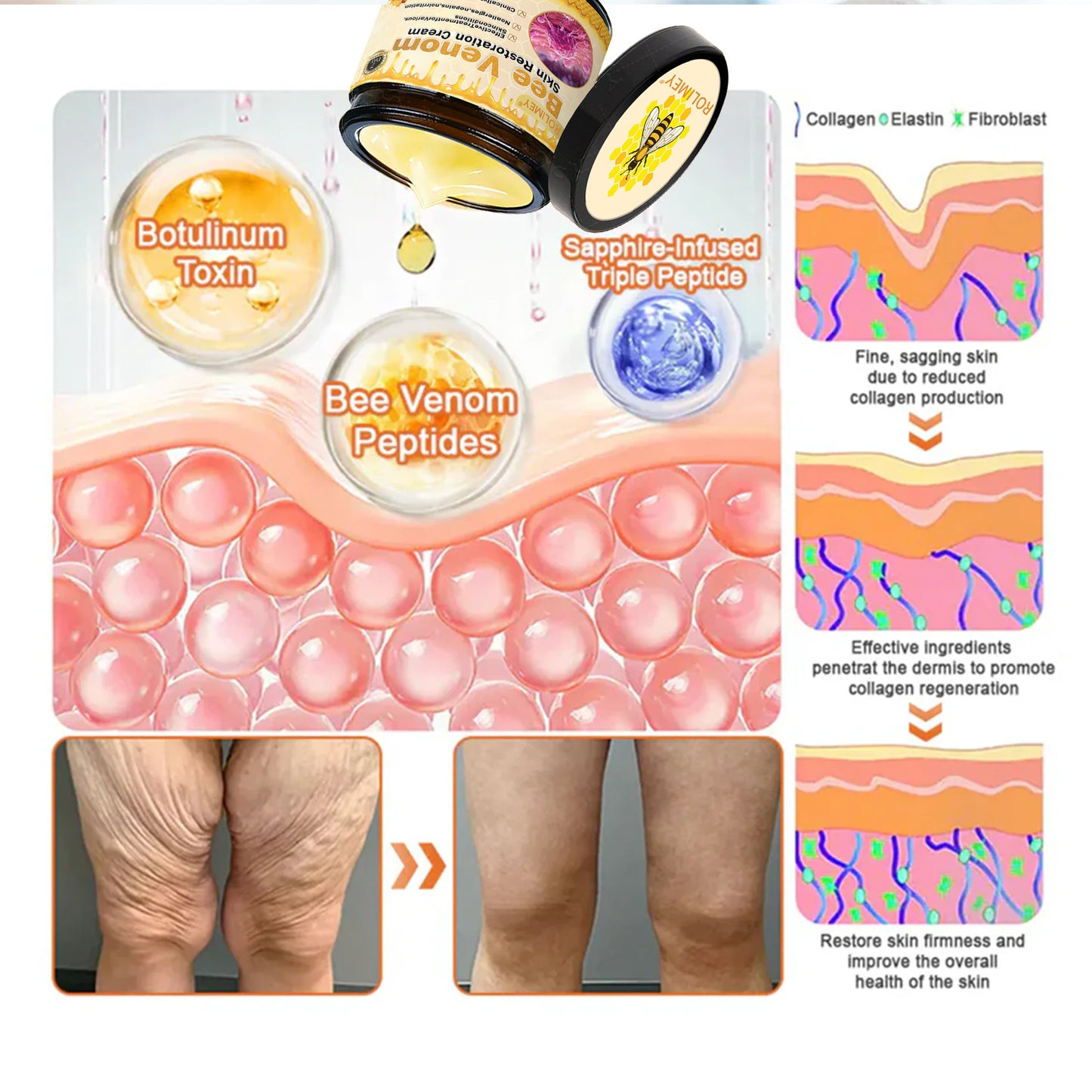 🎁Made and Shipped from UK🎁✨ Rolimey® Bee venom Pro Comprehensive Cream 🔥 LAST DAY 80% OFF