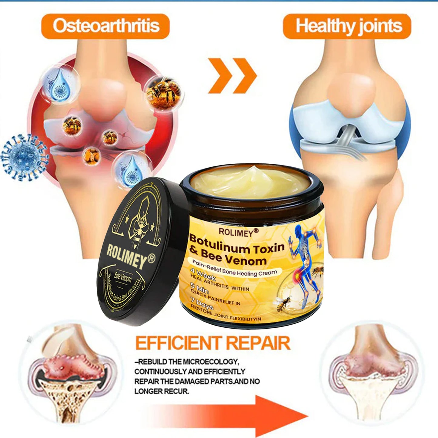 🌟Official Shop:Rolimey® Bee Venom Pain Relief Bone Healing Cream 👨‍⚕️(Reduction of joint swelling, pain, stiffness, redness, heat, muscle soreness and joint fatigue)