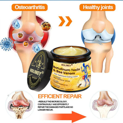 🌟Official Shop:Rolimey® Bee Venom Pain Relief Bone Healing Cream 👨‍⚕️(Reduction of joint swelling, pain, stiffness, redness, heat, muscle soreness and joint fatigue)