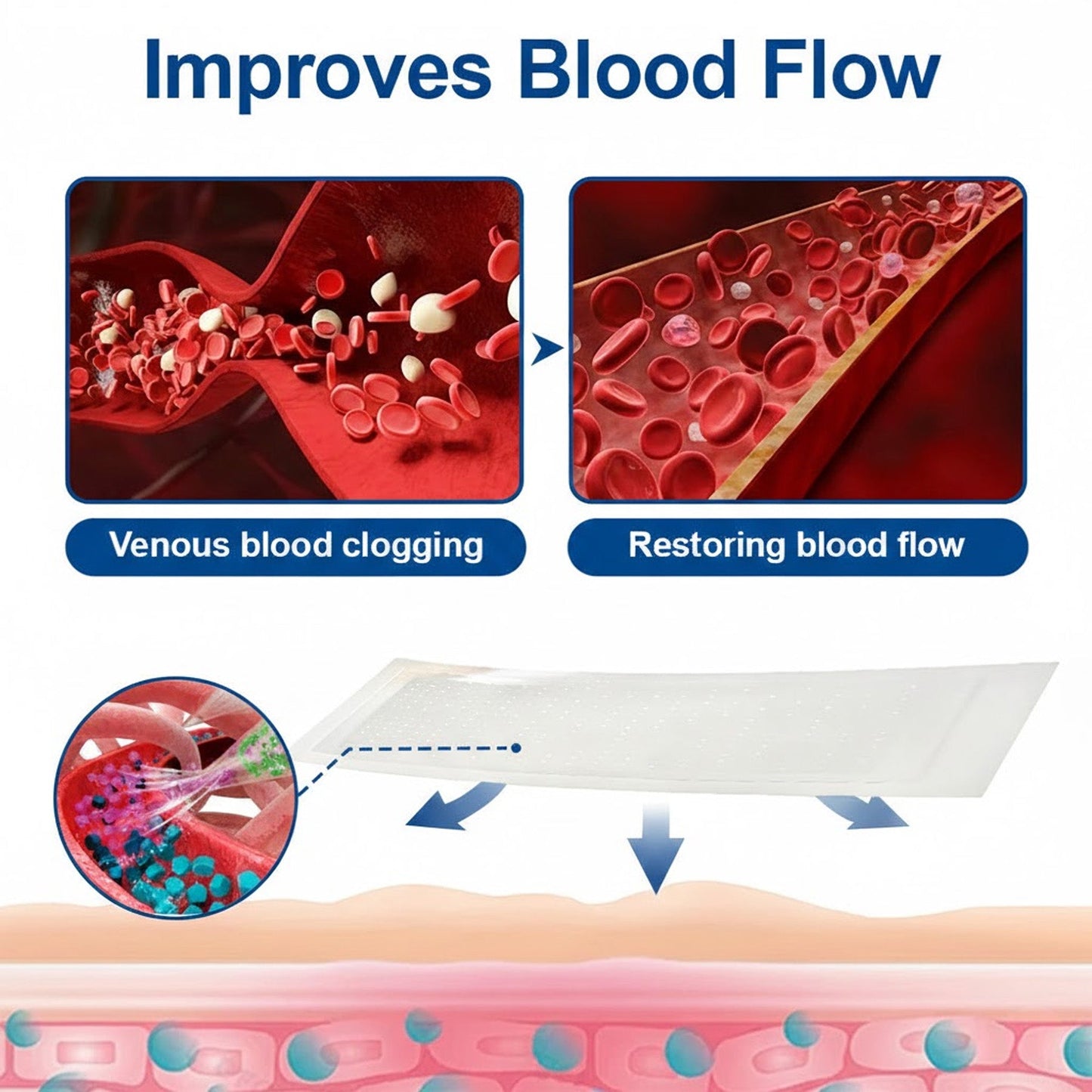 🇬🇧🌟👨‍⚕️GFOUK® VeinEase Microneedle Care Patch⚡Instant Relief, Long-Term Results