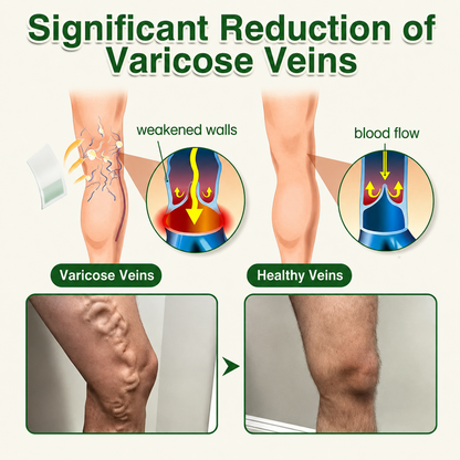 🇬🇧👨‍⚕️GFOUK® 7-in-1 Microneedle Vein & Lipedema Treatment Patch | Non-Surgical Alternative for Varicose Bulges, Spider Veins & Chronic Leg Swelling | Expert Approved