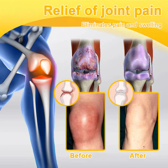🌟Official Shop:Rolimey® Bee Venom Pain Relief Bone Healing Cream 👨‍⚕️(Reduction of joint swelling, pain, stiffness, redness, heat, muscle soreness and joint fatigue)