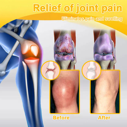 🌟Official Shop:Rolimey® Bee Venom Pain Relief Bone Healing Cream 👨‍⚕️(Reduction of joint swelling, pain, stiffness, redness, heat, muscle soreness and joint fatigue)