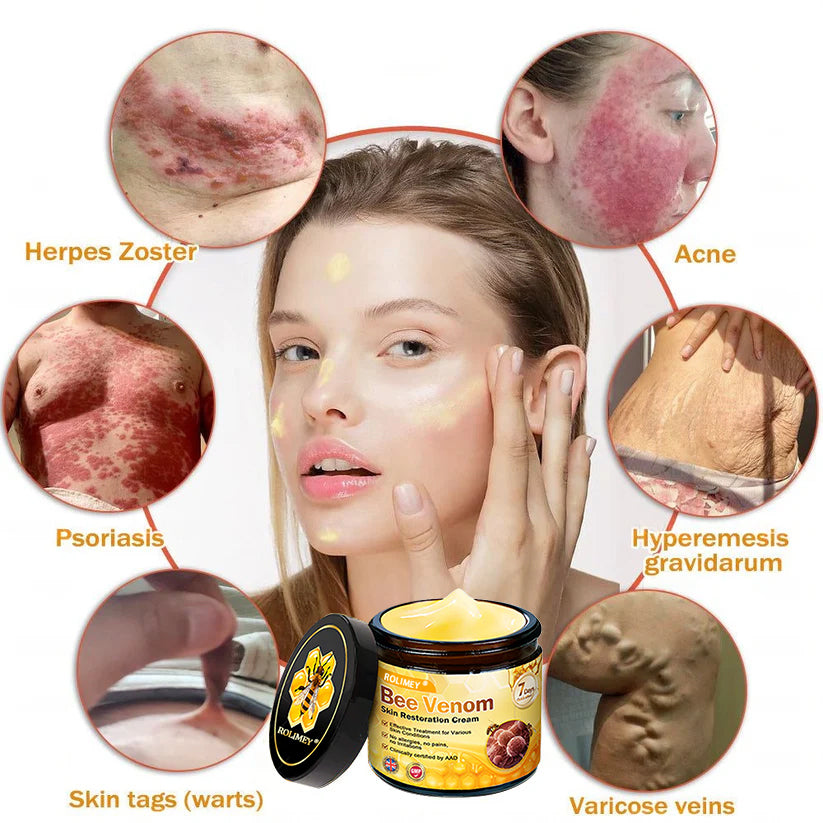🥇FDA Approved: Rolimey® Bee Venom Skin Restoration Cream — 🔥Limited Time 80% OFF🔥