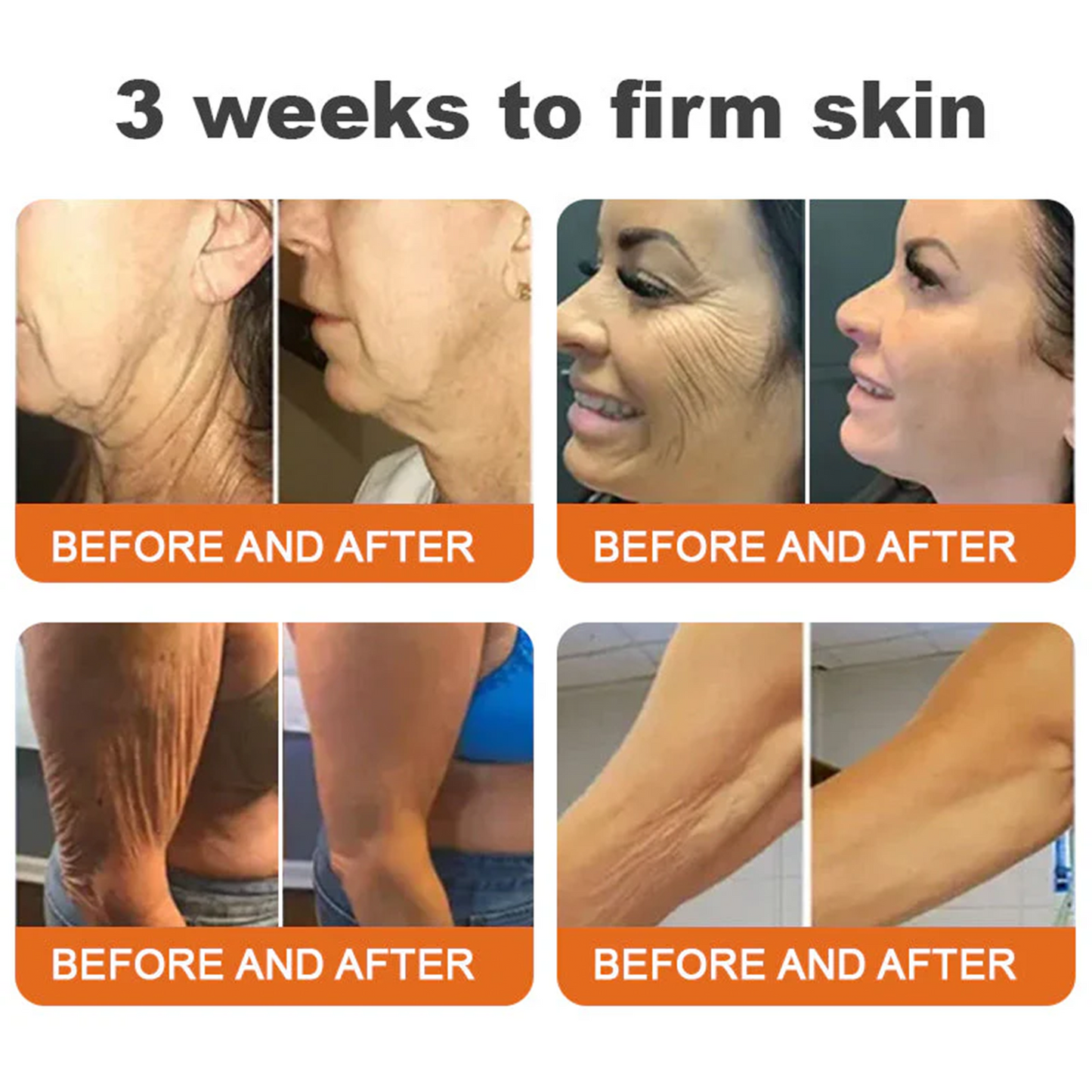 🎁Made and Shipped from UK🎁✨ Rolimey® Bee venom Pro Comprehensive Cream 🔥 LAST DAY 80% OFF