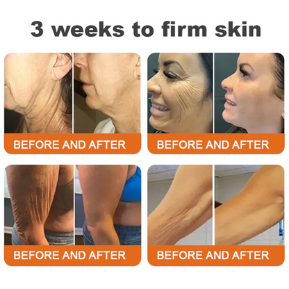 🎁Made and Shipped from UK🎁✨ Rolimey® Bee venom Pro Comprehensive Cream 🔥 LAST DAY 80% OFF