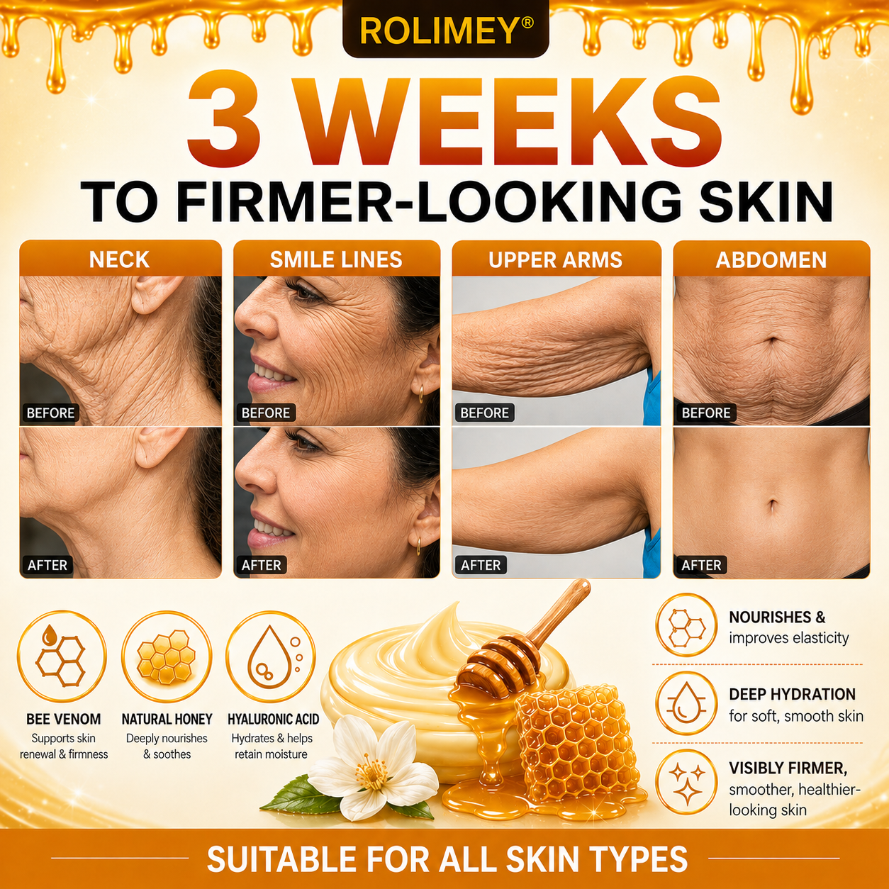 🔥2026 New Rolimey® Bee Venom Advanced Skin Rescue Cream | Botox-Inspired Firming & Smoothing Care for All Skin Types