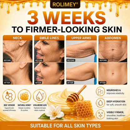 🔥2026 New Rolimey® Bee Venom Advanced Skin Rescue Cream | Botox-Inspired Firming & Smoothing Care for All Skin Types
