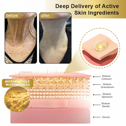 🎁Made and shipped in the UK 💫Rolimey® Collagen Fullerene Cream, Rolimey Collagen Cream with Collagen Peptides, 2026 New Tighten & Lift Cream for Crepey Skin, Wrinkles and Tightening for Skin Types