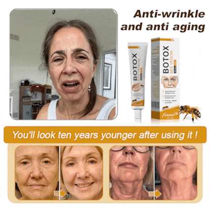 (🌟Made and Shipped from UK✅) Official Store |Furzero™ Botox Bee Venom Wrinkle Removal Cream- LAST DAY 70% OFF