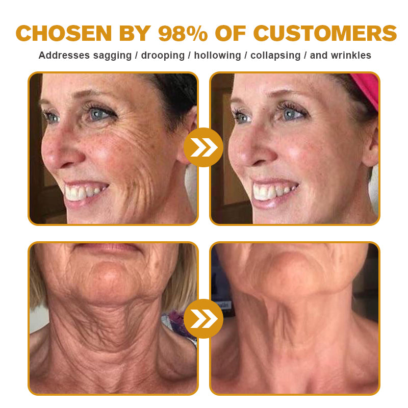 (🌟Made and Shipped from UK✅) Official Store |Furzero™ Botox Bee Venom Wrinkle Removal Cream- LAST DAY 70% OFF