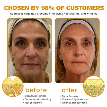 (🌟Made and Shipped from UK✅) Official Store |Furzero™ Botox Bee Venom Wrinkle Removal Cream- LAST DAY 70% OFF