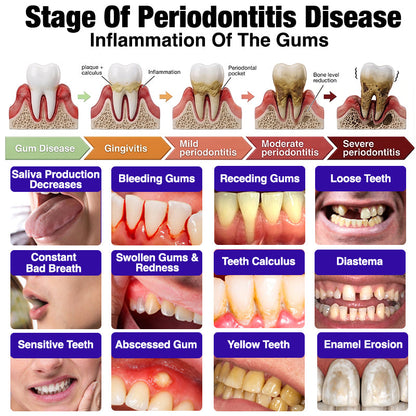 🇬🇧🧑‍⚕️🦷Evolvion® Bee Venom Gingivitis & Periodontitis Treatment Toothpaste🎁